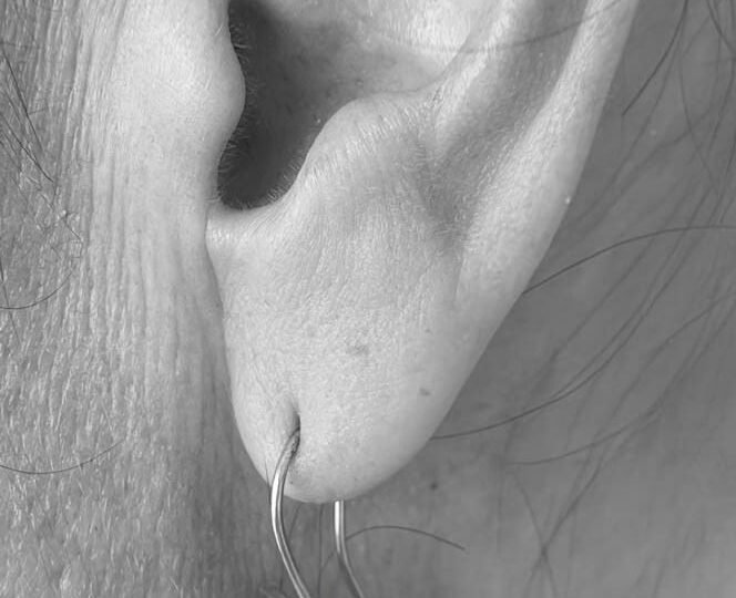 Cosa hai detto? Non sento! 36aefb78 05f0 49f8 be92 c4d41c9525e2