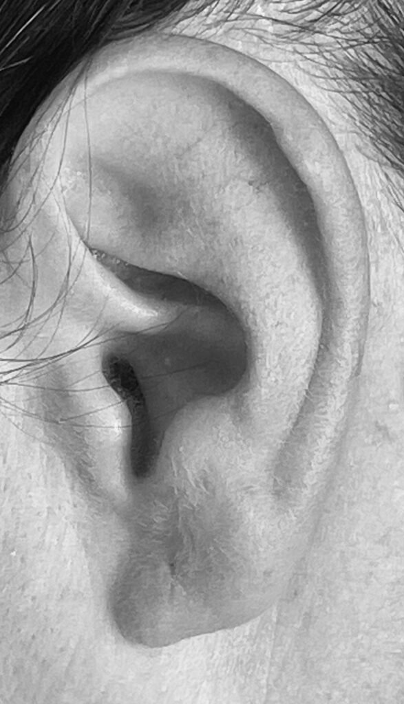 Cosa hai detto? Non sento! img 6447